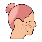 Skin & Acne Issues - JustDocto